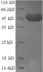 Human DCP2 protein