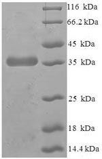 Human PTPMT1 protein