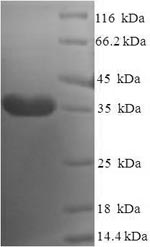 Human DYDC2 protein