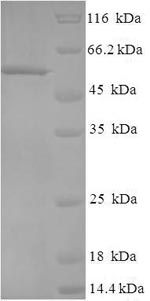 Human RMDN3 protein
