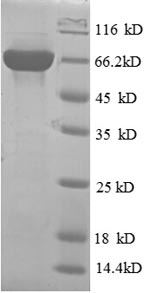 Human PLD5 protein