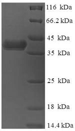 Human DNAJB8 protein