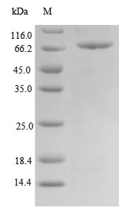 Human TBX15 protein