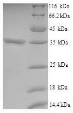 Human VSTM2L protein