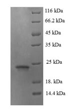 Mouse Gm6484 protein