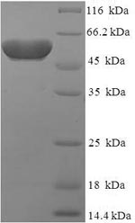Human ATOH1 protein
