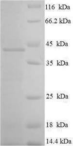 Human RAB3C protein