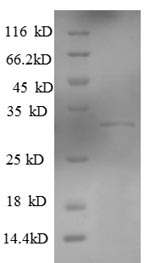 Human KLRG1 protein
