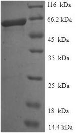 Human NEIL1 protein