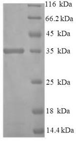 Human TMX3 protein