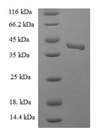 Human ESAM protein