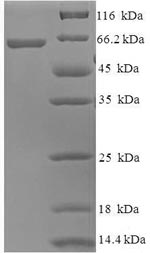 Human AMDHD1 protein