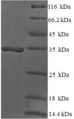 Human DAND5 protein