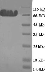 Human MYLIP protein