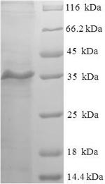 Human MYLPF protein