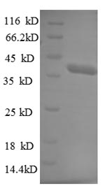 Human TRIM11 protein