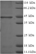 Human HSD17B14 protein