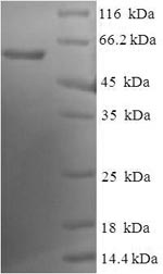 Human ERP44 protein