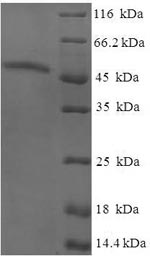 Human AKTIP protein