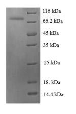 Human HSPA6 protein