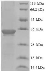 Human DBNDD2 protein