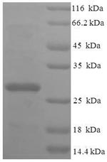 Human MRPL20 protein