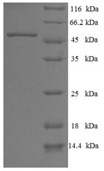 Human AASDHPPT protein