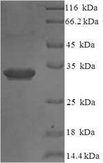 Human IL36RN protein