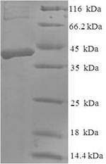 Human DKK2 protein