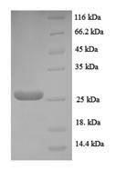 Human NRN1 protein