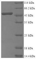 Human MRPL1 protein