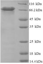 Human CPVL protein