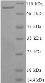 Human XPNPEP1 protein