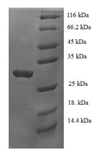 Human PDRG1 protein