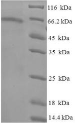 Human TUBB6 protein