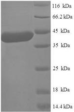 Human NTMT1 protein