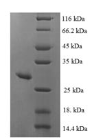 Human MSRA protein