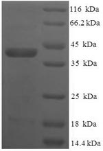Human VTI1B protein