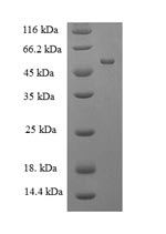 Human MBNL1 protein