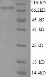 Human RAD18 protein