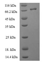 Human BAG5 protein