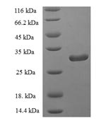 Human PLA2G2D protein