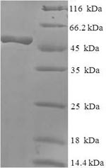 Human RPH3AL protein