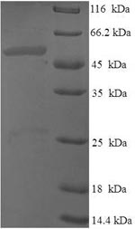 Human DIMT1 protein