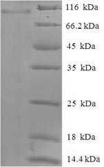 Human PADI2 protein