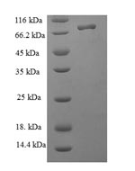Human NOP58 protein