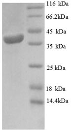 Human PAM16 protein