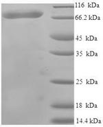 Human USH1C protein