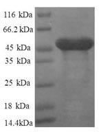 Human RPL11 protein