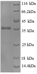 Human HSBP1 protein